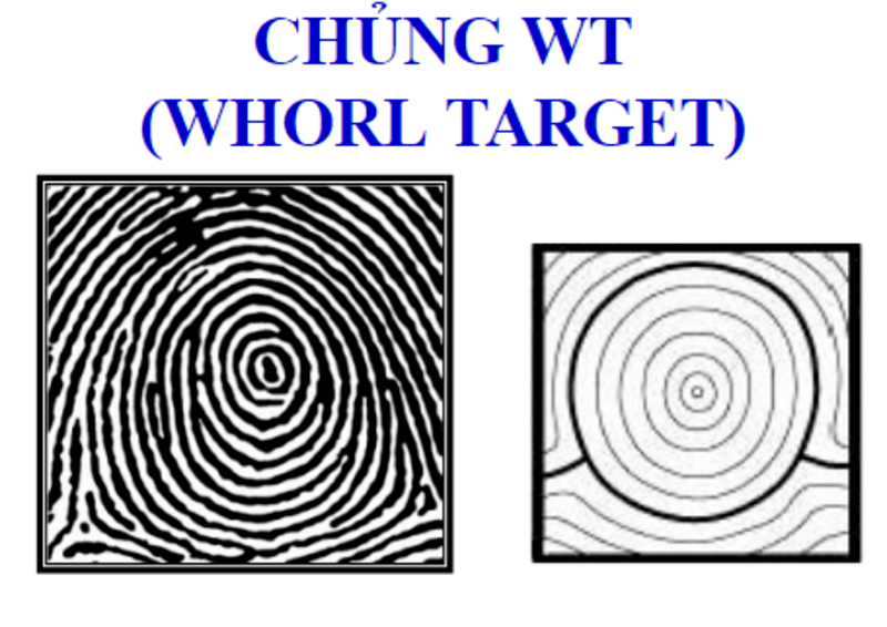 Chủng Wt(Target Whorl) 