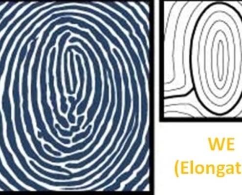chủng vân tay whorl