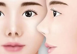 Tướng mũi hếch trong Nhân tướng học