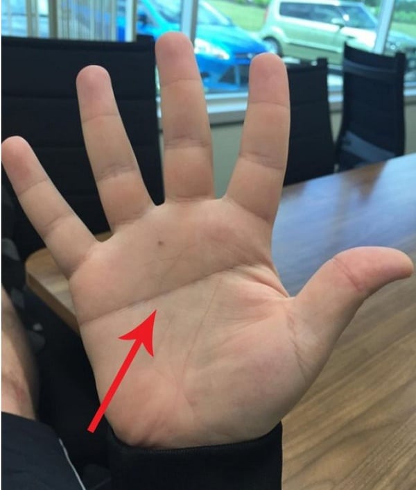 Bàn tay có 2 đường chỉ tay ở tay phải nữ